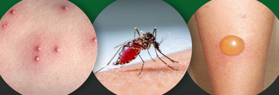 Tipo de alergia 2